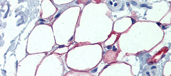 NFIC Rabbit Polyclonal Antibody