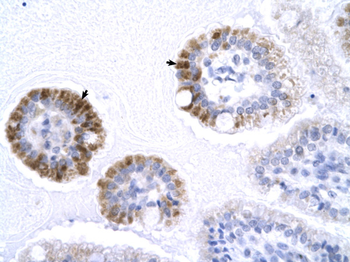 GTF2B Rabbit Polyclonal Antibody