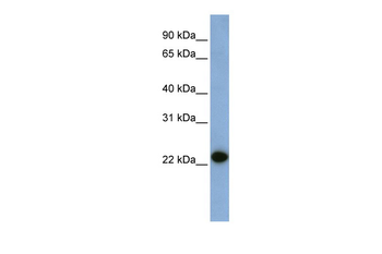 CAV1 Rabbit Polyclonal Antibody
