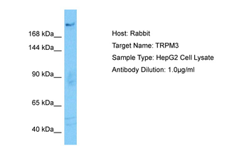 TRPM3 Rabbit Polyclonal Antibody