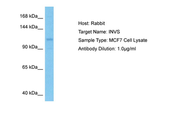 INVS Rabbit Polyclonal Antibody