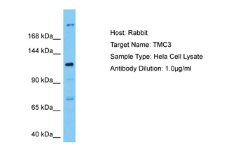 TMC3 Rabbit Polyclonal Antibody