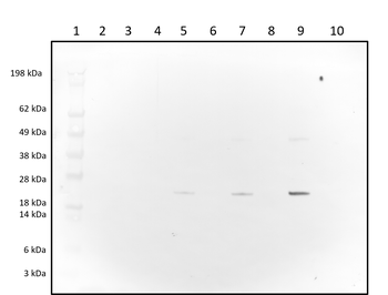 Rabbit polyclonal antibodies to HLA
