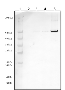 Rabbit polyclonal antibodies to Insulin Receptor