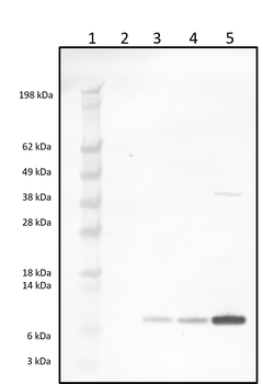Rabbit polyclonal antibodies to Beta-2-Microglobulin