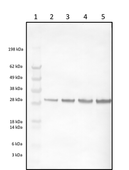 Rabbit polyclonal antibodies to Prostate Specific Antigen (PSA)
