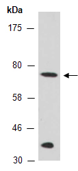 ETR1 (N) Antibody, Rabbit Polyclonal
