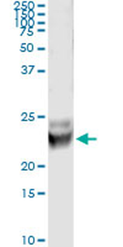 RAB7B monoclonal antibody (M01), clone 3B3
