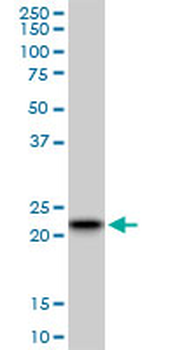 RAB7B monoclonal antibody (M01), clone 3B3