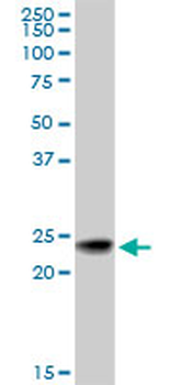 RAB7B monoclonal antibody (M01), clone 3B3