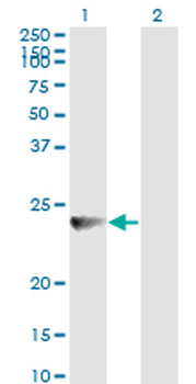 RAB7B monoclonal antibody (M01), clone 3B3