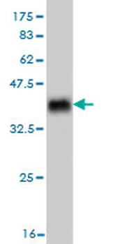 RAB7B monoclonal antibody (M01), clone 3B3