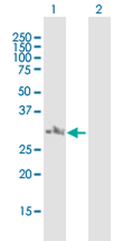 NSMCE2 MaxPab mouse polyclonal antibody (B01)