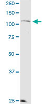 KSR2 monoclonal antibody (M08), clone 1G4