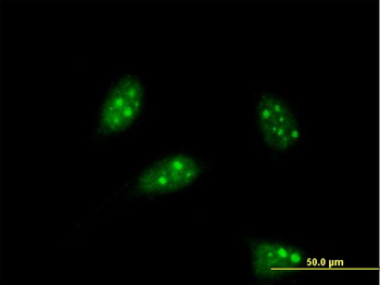 PTF1A monoclonal antibody (M05), clone 1A2