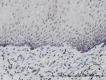 PTF1A monoclonal antibody (M05), clone 1A2