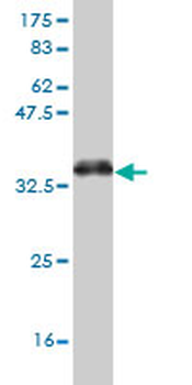 PTF1A monoclonal antibody (M05), clone 1A2