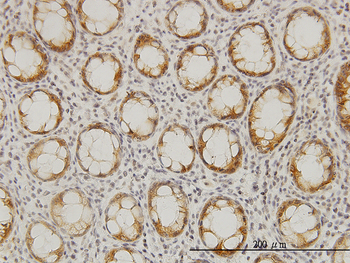 LASS6 monoclonal antibody (M01), clone 5H7