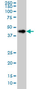 LASS6 monoclonal antibody (M01), clone 5H7