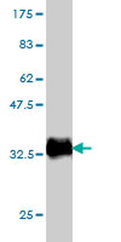 LASS6 monoclonal antibody (M01), clone 5H7