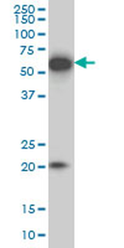 EBF3 monoclonal antibody (M05), clone 8D6
