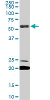 EBF3 monoclonal antibody (M05), clone 8D6