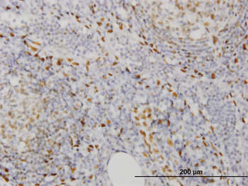 EBF3 monoclonal antibody (M05), clone 8D6