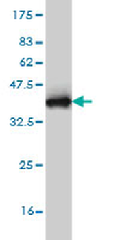 EBF3 monoclonal antibody (M05), clone 8D6