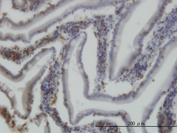 RICTOR monoclonal antibody (M01), clone 1F3