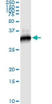 RICTOR monoclonal antibody (M01), clone 1F3