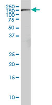 RICTOR monoclonal antibody (M01), clone 1F3