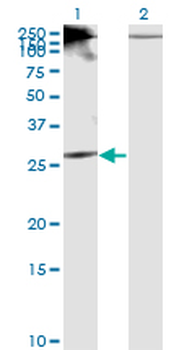 RICTOR monoclonal antibody (M01), clone 1F3