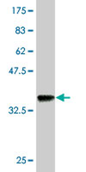 RICTOR monoclonal antibody (M01), clone 1F3