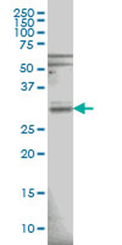 RNASEH1 monoclonal antibody (M01), clone 5D10