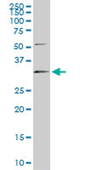 RNASEH1 monoclonal antibody (M01), clone 5D10