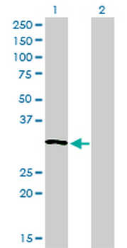 RNASEH1 monoclonal antibody (M01), clone 5D10