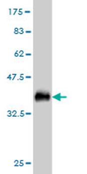 RNASEH1 monoclonal antibody (M01), clone 5D10