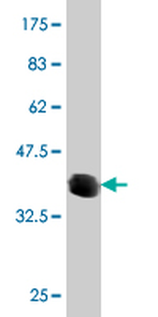 ATP6V0D2 monoclonal antibody (M01), clone 7A4