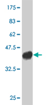 UBR1 monoclonal antibody (M01), clone 2F5