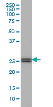 PHOSPHO1 monoclonal antibody (M04), clone 4B2