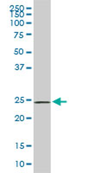 PHOSPHO1 monoclonal antibody (M04), clone 4B2