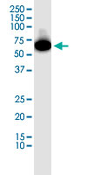 SGOL1 monoclonal antibody (M01), clone 3C11