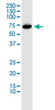 SGOL1 monoclonal antibody (M01), clone 3C11