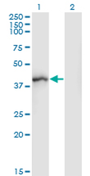 SGOL1 monoclonal antibody (M01), clone 3C11