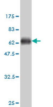 SGOL1 monoclonal antibody (M01), clone 3C11