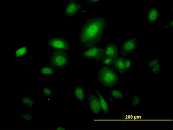 SEPT10 monoclonal antibody (M01), clone 2A12