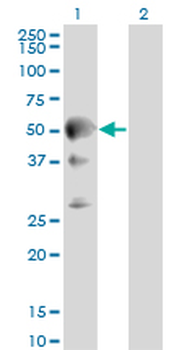 SEPT10 monoclonal antibody (M01), clone 2A12