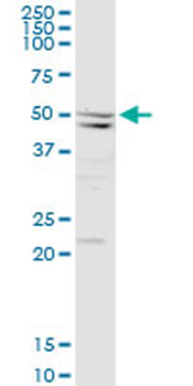 SEPT10 MaxPab rabbit polyclonal antibody (D01)