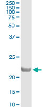 COMMD1 monoclonal antibody (M01), clone 2A12