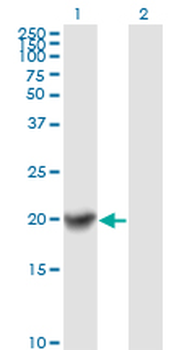 COMMD1 monoclonal antibody (M01), clone 2A12